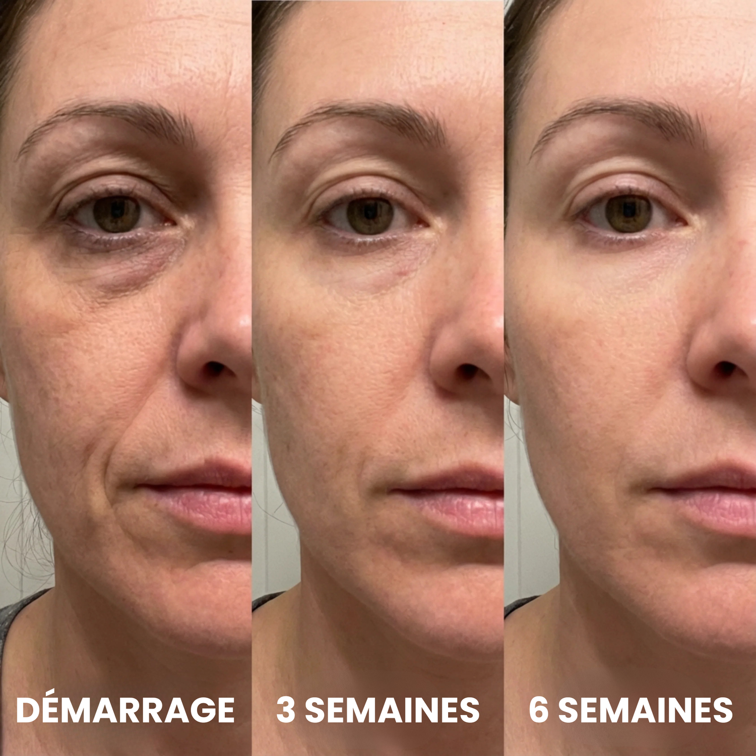 Résultats : démarrage, 3 semaines, 6 semaines