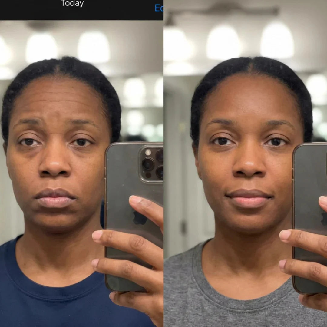 Antes / depois amandine
