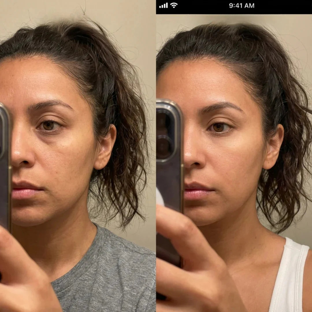 Antes / depois justine