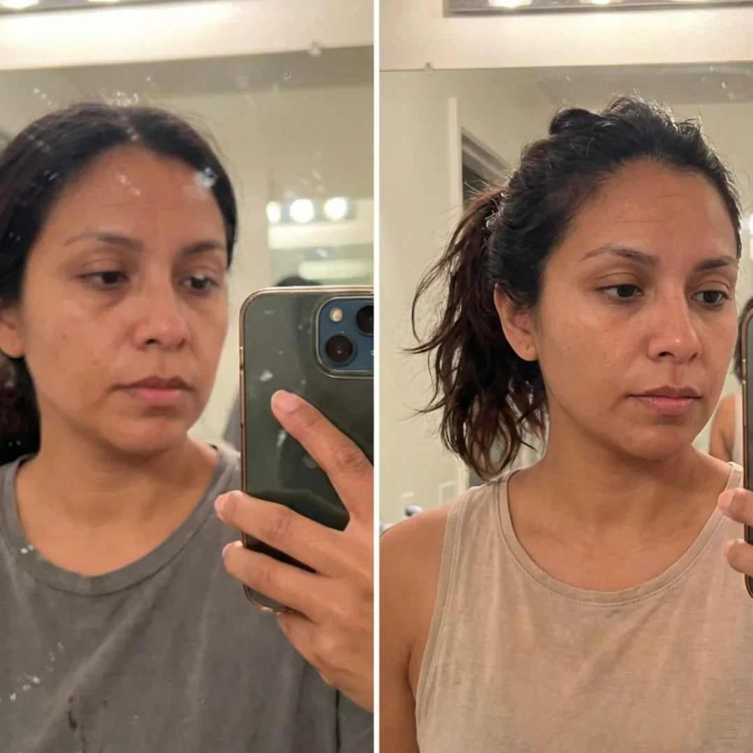 Antes / depois laure