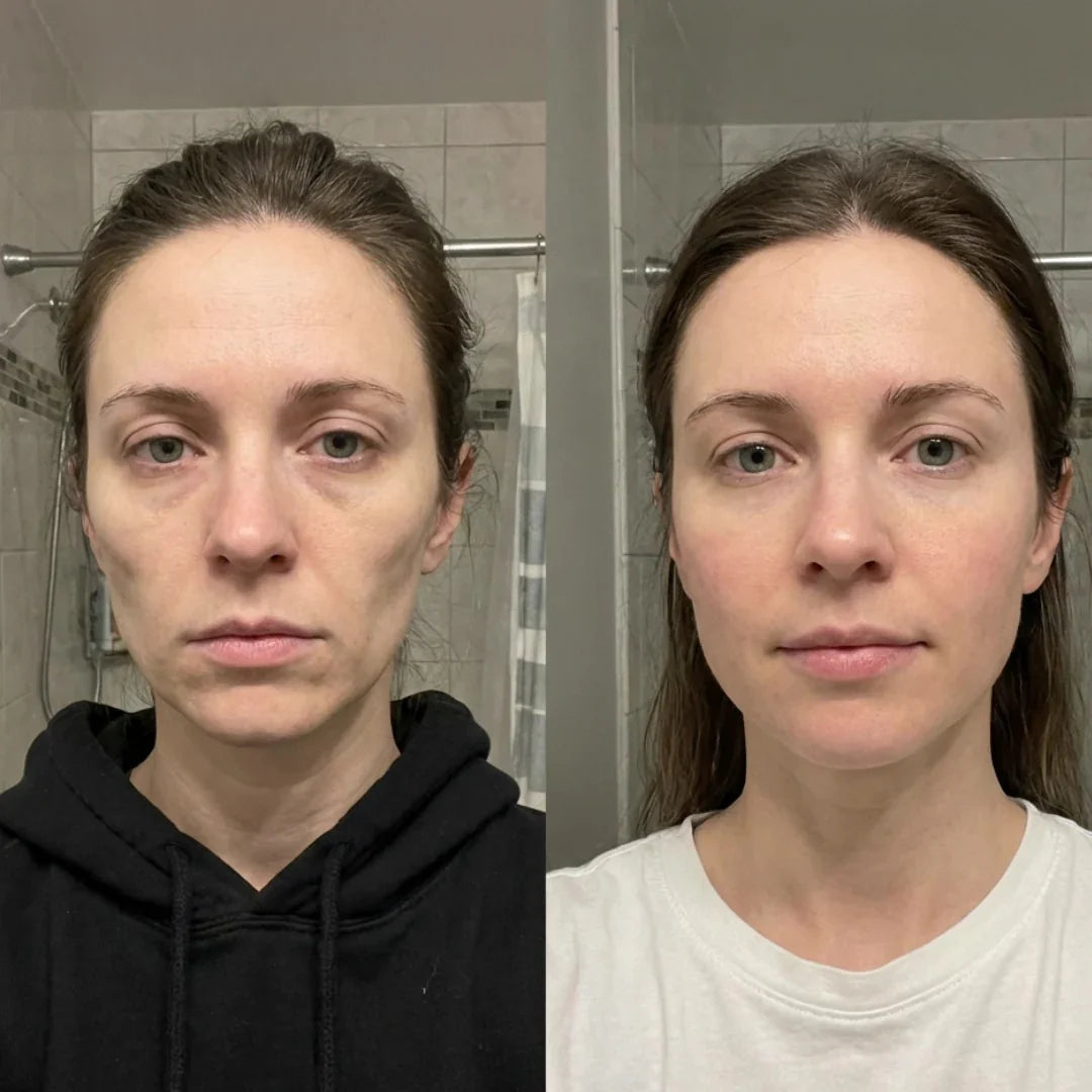 Antes / depois sarah
